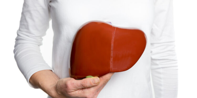 How do you recognize liver fat?